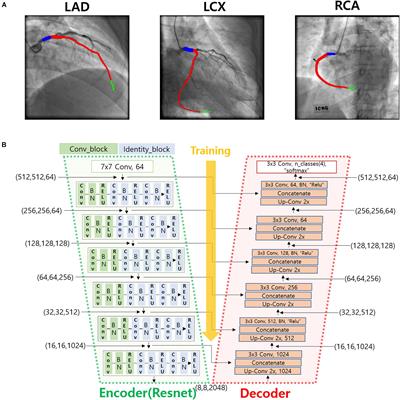 A Simple Method for Automatic 3D Reconstruction of Coronary Arteries From X-Ray Angiography